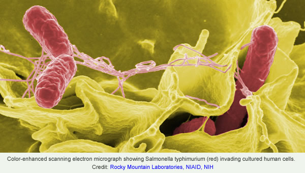 scanning electron microscope showing salmanella typhimurium invading cultured human cells