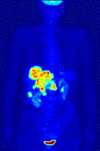 pet scan animation