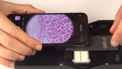Smart phone microscope