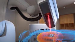A closeup of large medical robot arm and scanning device hovering over a blue see-through virtual patient with orange internal organs. A simulated red beam connects the scanning device and the patient.